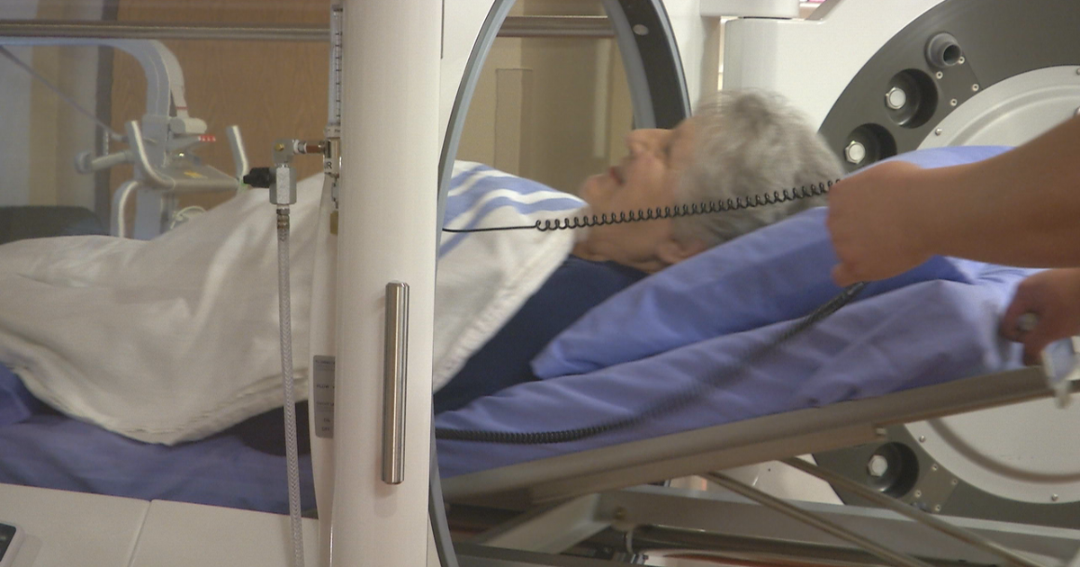After years of pain, hyperbaric therapy helps a Duluth woman walk again | News After years of pain, hyperbaric therapy helps a Duluth woman walk again | News