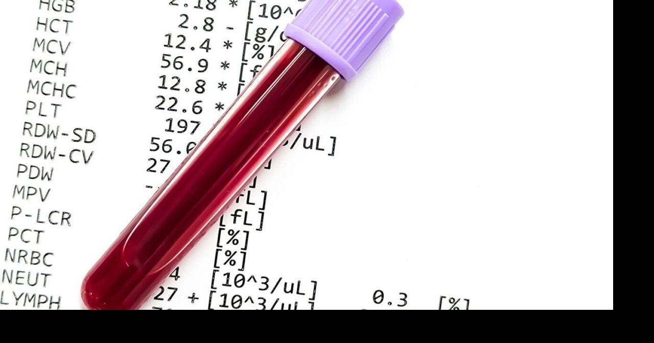 No test can confirm perimenopause. Doctors say you should get one anyway | Health