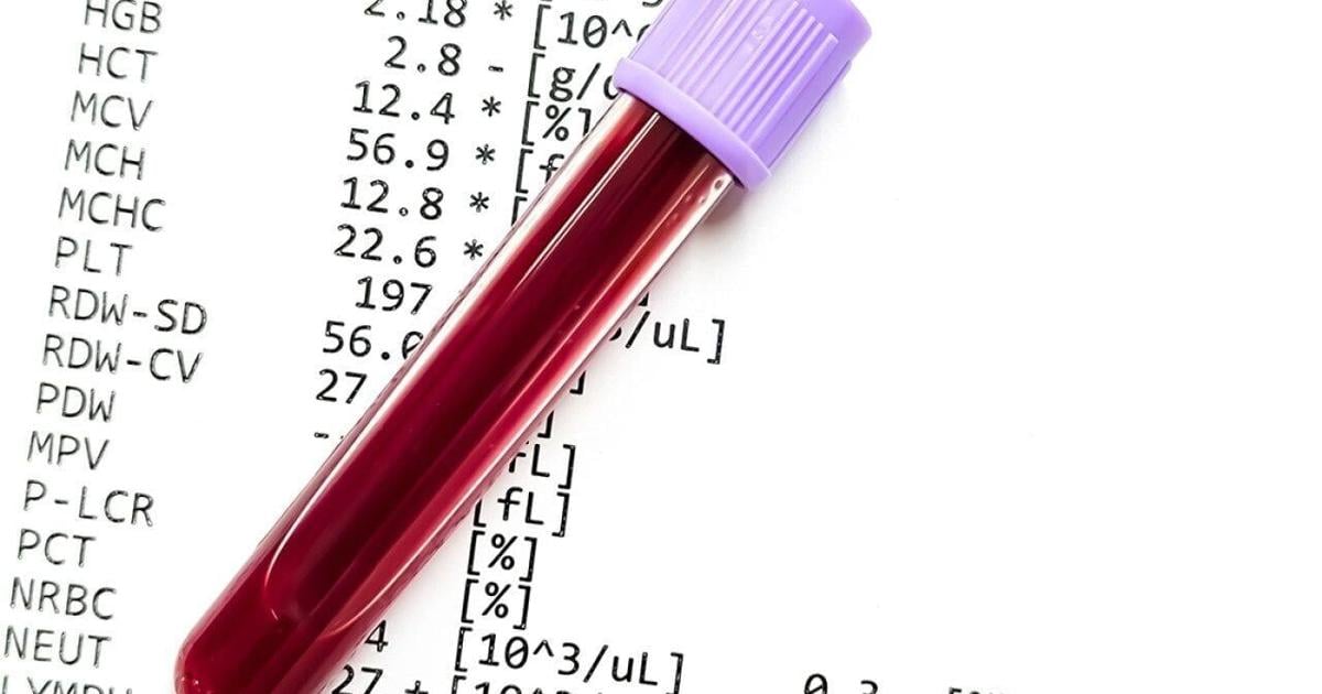 No test can confirm perimenopause. Doctors say you should get one anyway | Health No test can confirm perimenopause. Doctors say you should get one anyway | Health