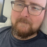 Man’s stomach pain turns out to be pancreatic cancer | Health Man’s stomach pain turns out to be pancreatic cancer | Health