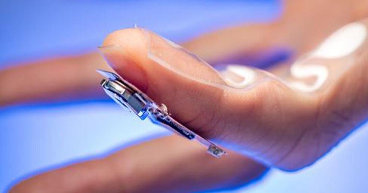 Sweat-powered patch tracks Parkinson’s patient medication levels | Health Sweat-powered patch tracks Parkinson’s patient medication levels | Health