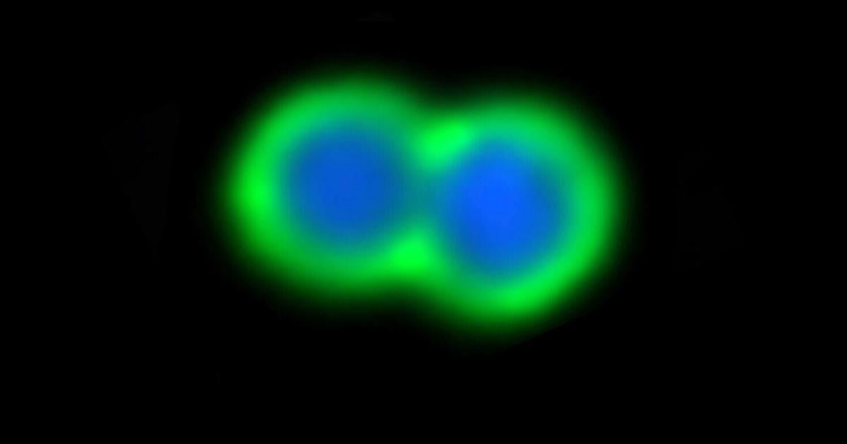 How human antibodies could help defeat drug-resistant superbugs | Health How human antibodies could help defeat drug-resistant superbugs | Health