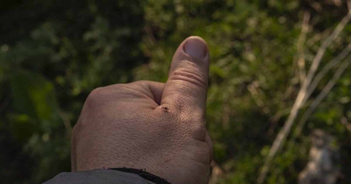 Warmer temps bring soaring tick populations. Here’s how to stay safe from Lyme disease | Health Warmer temps bring soaring tick populations. Here’s how to stay safe from Lyme disease | Health