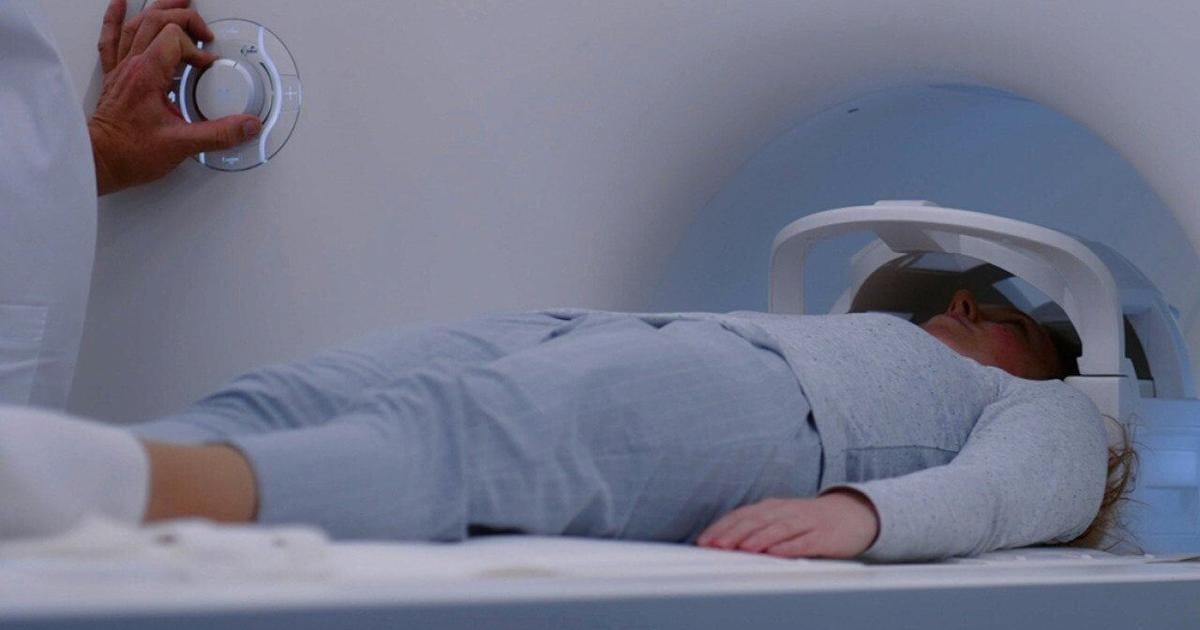 New-onset seizures as an early warning for brain tumors | Health New-onset seizures as an early warning for brain tumors | Health