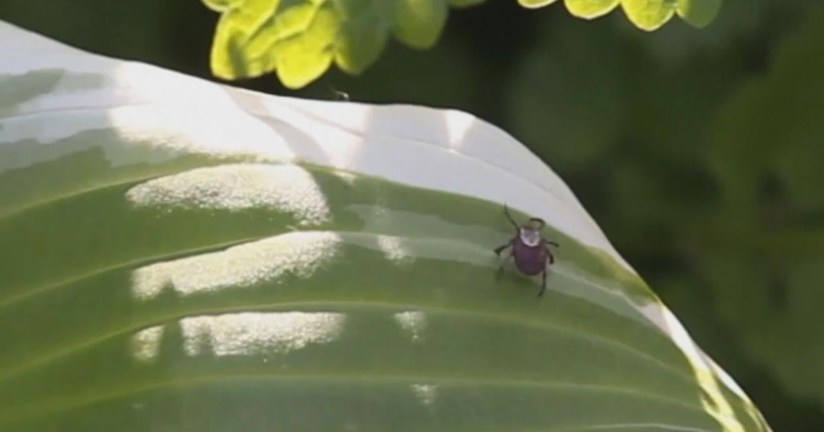 Ticks season is here; Dr weighs in on how to prevent and seek care for bites | Local & State News Ticks season is here; Dr weighs in on how to prevent and seek care for bites | Local & State News