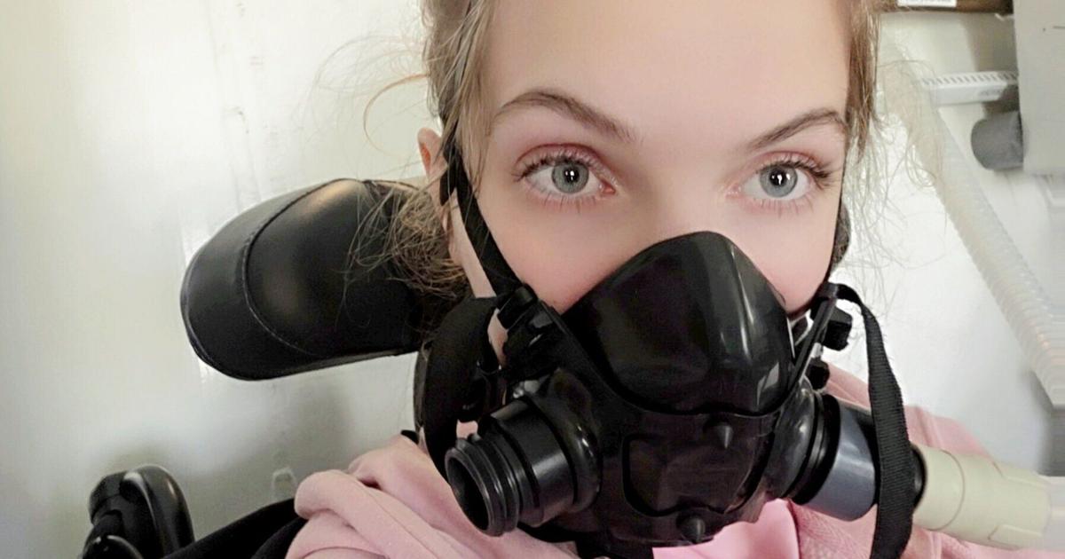Teen told seizures were ‘anxiety’ left brain damaged at age 16 | Health Teen told seizures were ‘anxiety’ left brain damaged at age 16 | Health