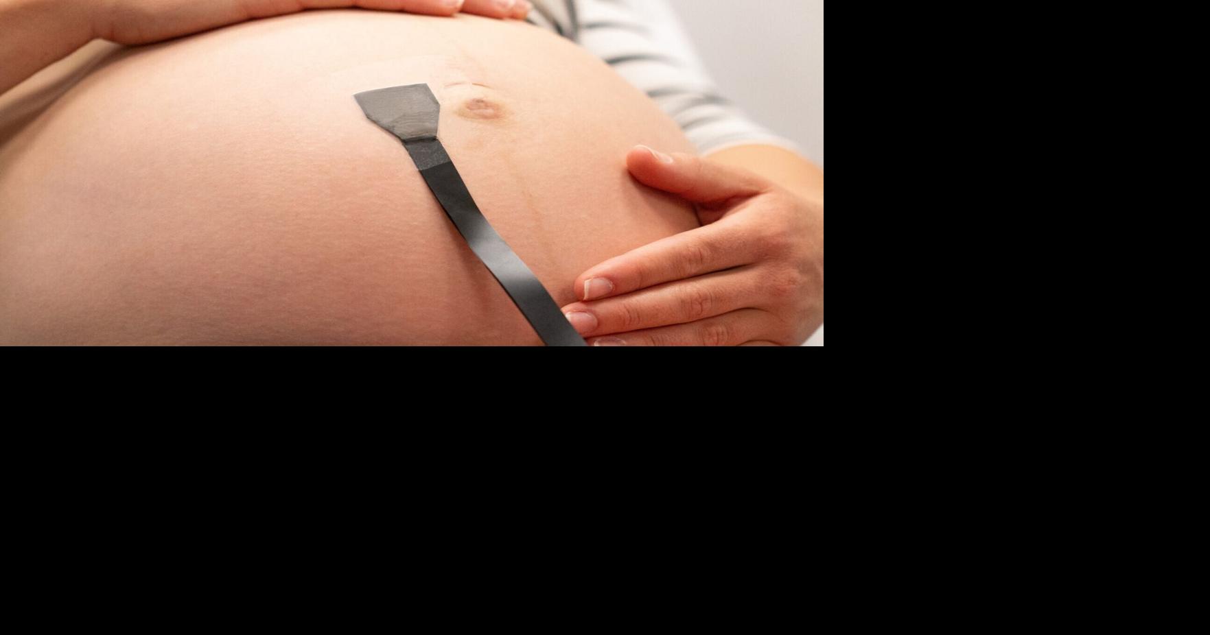 Wearable patch offers 24/7 monitoring for high-risk pregnancies | Health