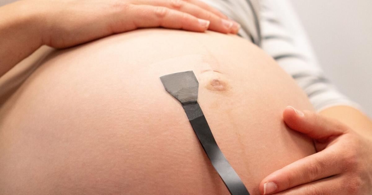 Wearable patch offers 24/7 monitoring for high-risk pregnancies | Health Wearable patch offers 24/7 monitoring for high-risk pregnancies | Health