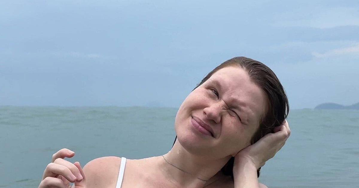 How to get rid of swimmer’s ear and prevent it from coming back | Health How to get rid of swimmer’s ear and prevent it from coming back | Health