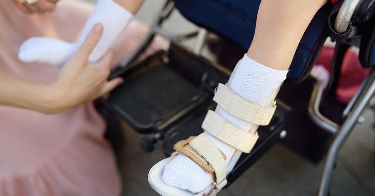 Stem cell therapy for cerebral palsy moves closer to US trials | Health Stem cell therapy for cerebral palsy moves closer to US trials | Health