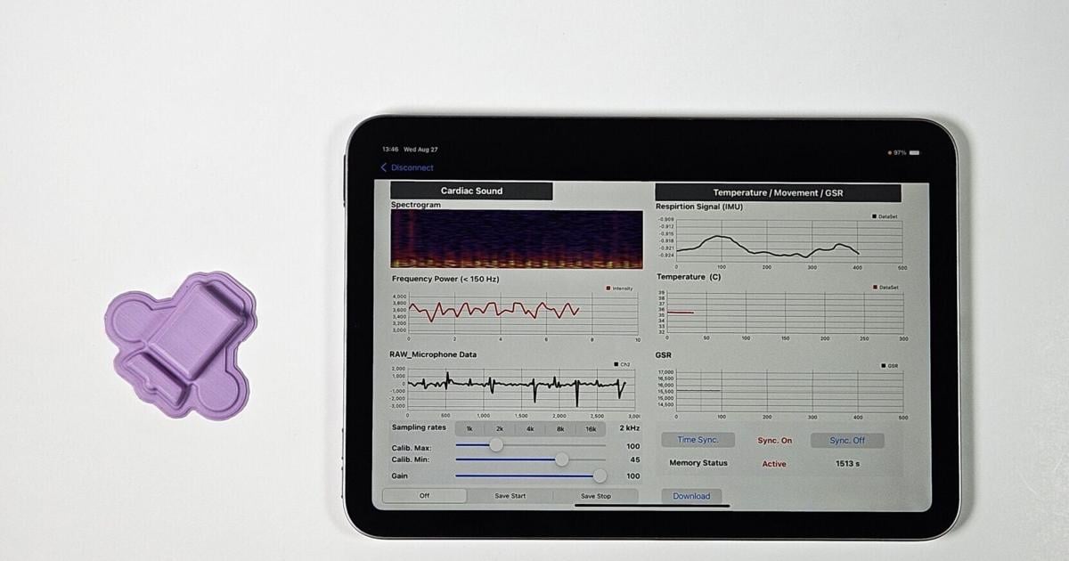 Stress-sensing lie detector can also spot distressed babies | Health Stress-sensing lie detector can also spot distressed babies | Health