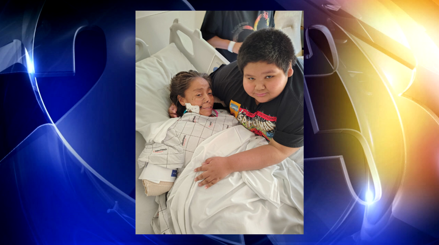 Woman loses both arms, legs after being attacked by two pit bulls | News |  fox23.com