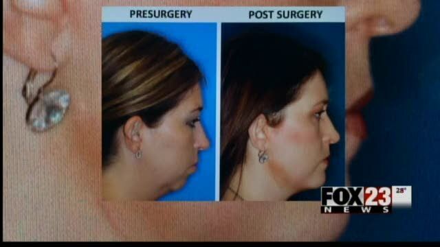 TMJ treatments can be controversial News fox23