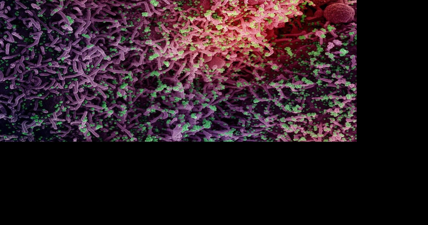 COVID Cover-Up: Hiding Star Researcher Ralph Baric’s Ties to Global Pandemic