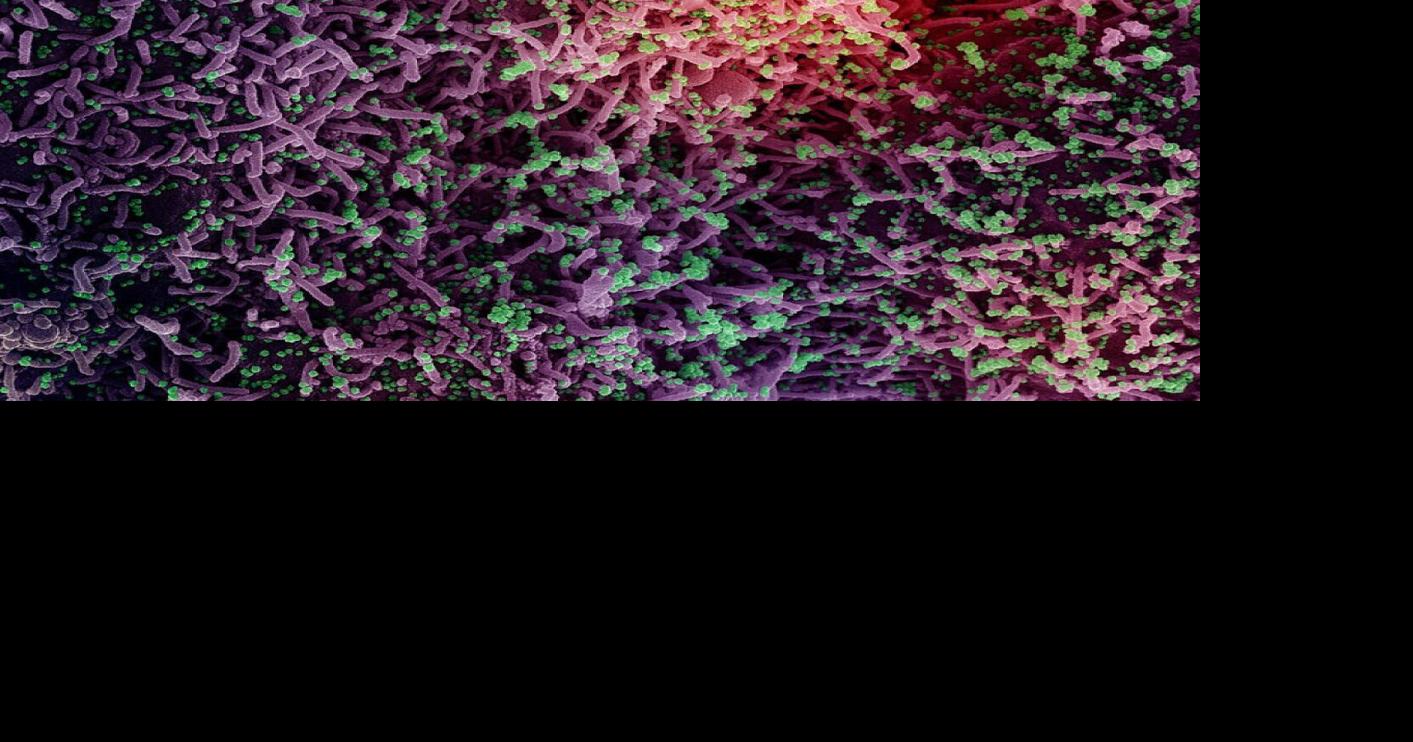 Two New Books Bash Covid Failures