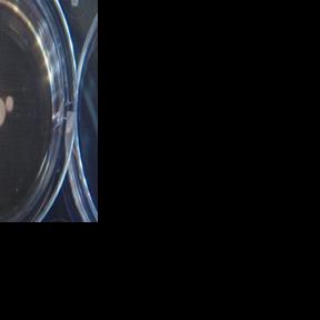 Oldest human brain cells grown in lab 'recorded passage of time' Daniel Lawler Aug 19, 2026 Aug 19, 2026 Updated 6 mins ago