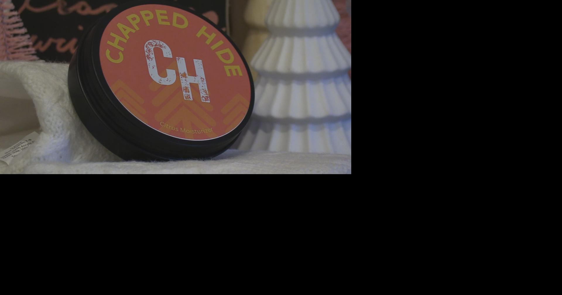 Battling bug bites with Chapped Hide | News | foxbangor.com