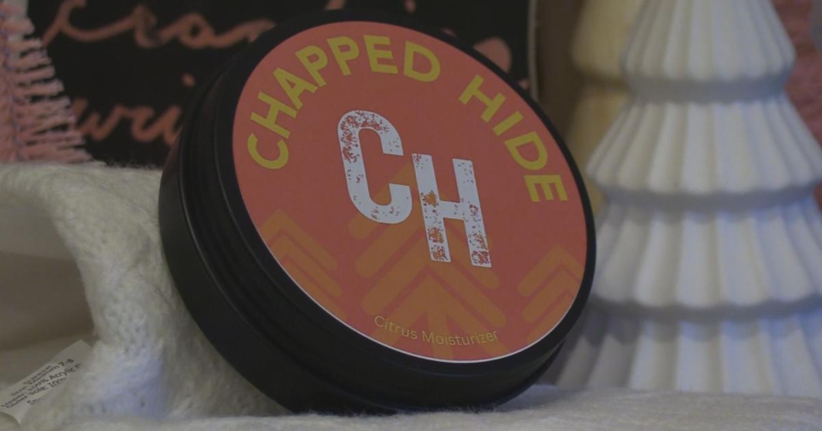 Battling bug bites with Chapped Hide | News | foxbangor.com