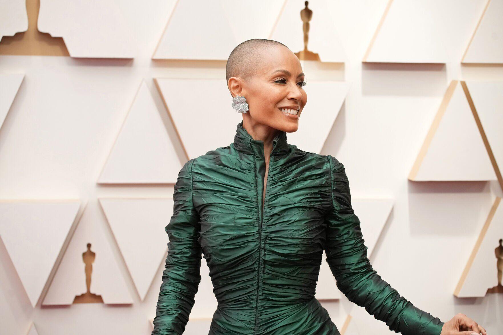 Oscars controversy shines a light on Jada Pinkett Smith's alopecia