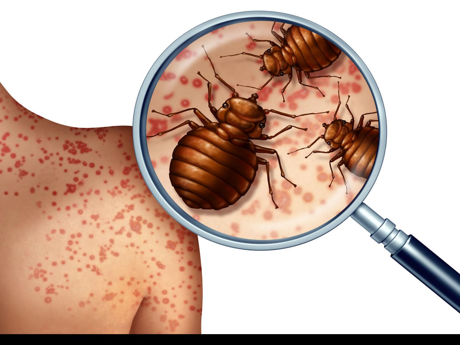 Washington Ranks No 1 On Bedbug List Richmond And Norfolk Make The Top 25 State Region Fredericksburg Com
