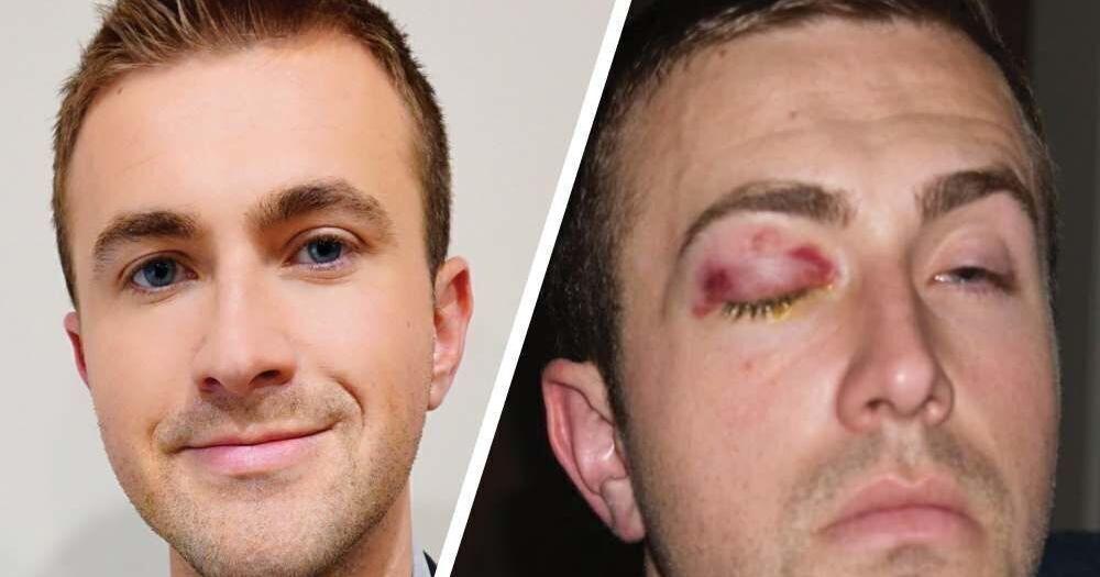 Lawsuit against Sarpy County over pepper ball injury during 2020 protest will proceed on two of four claims