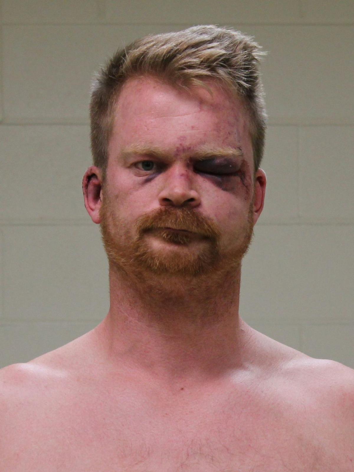Mason City man arrested for shoving, knocking out woman