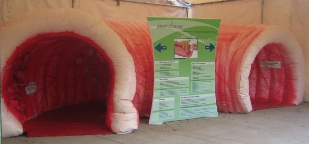 Super Colon To Be On Display At Mercy Mason City North Iowa