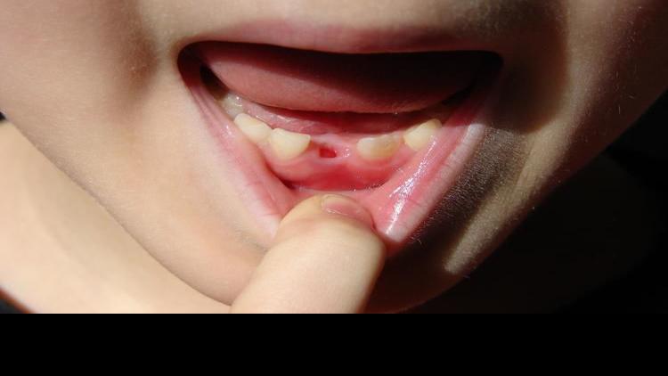 Blue Sky Science How And Why Do Our Teeth Fall Out Science Globegazette Com
