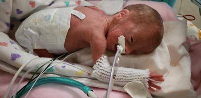 mindre unse barm A little miracle': Woden couple grateful for daughter born at 23 weeks  (with photos) | Mason City & North Iowa | globegazette.com