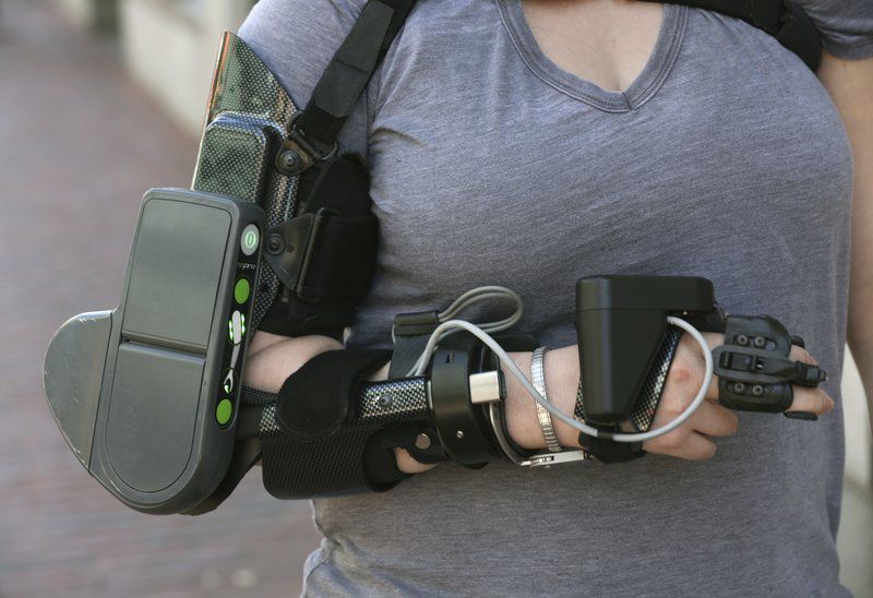 Mechanical assist Woman survives stroke, wears powered arm brace