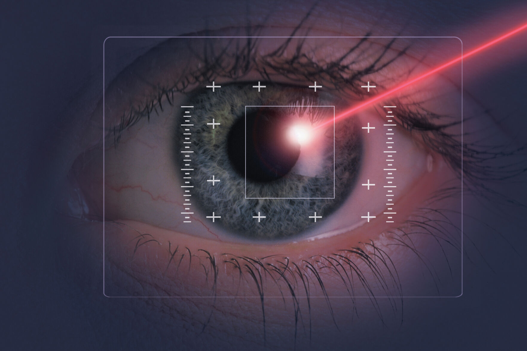 Using Lasers To Treat Eye Diseases | Vista Eye Care | Gvnews.com