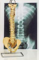 Exciting new treatments for spinal pain without major surgery