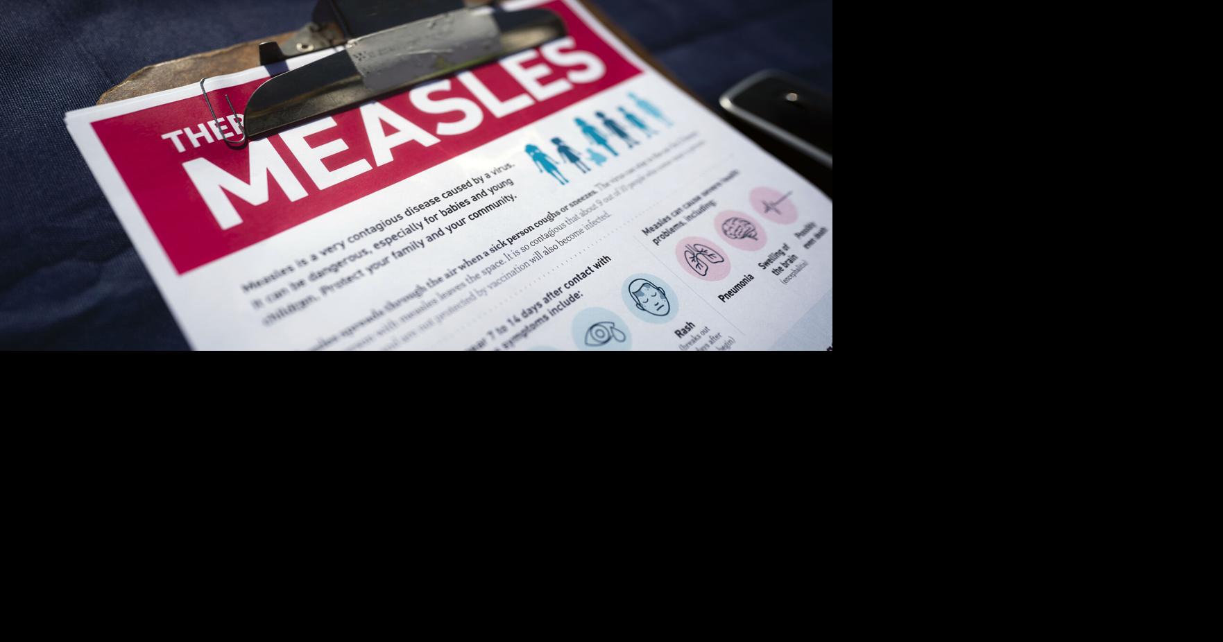 Maryland shopping center exposed to measles last week, officials say