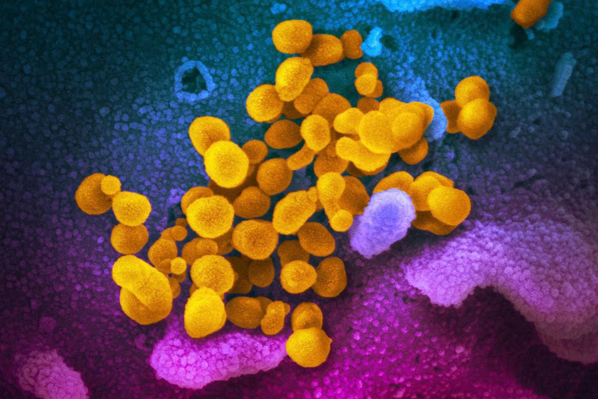 Coronavirus image