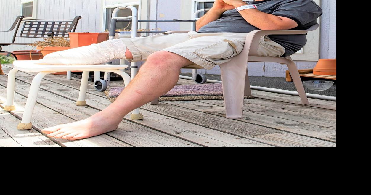 Loss of leg throws Helena car wash worker a 'curve ball'