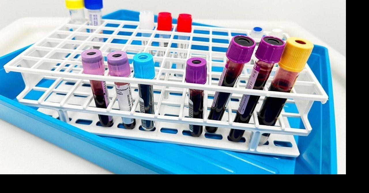 A single US measles outbreak can cost millions of dollars, study estimates Nancy Lapid Reuters Aug 8, 2026 9 mins ago