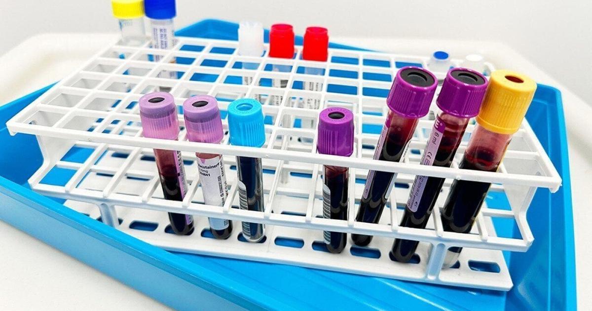 A single US measles outbreak can cost millions of dollars, study estimates Nancy Lapid Reuters Aug 8, 2026 9 mins ago