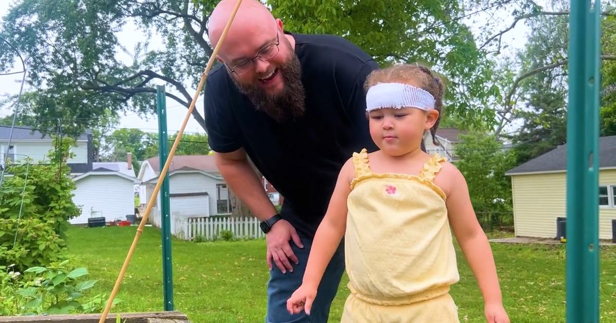Decatur family trying to heal from dog attack on 3-year-old