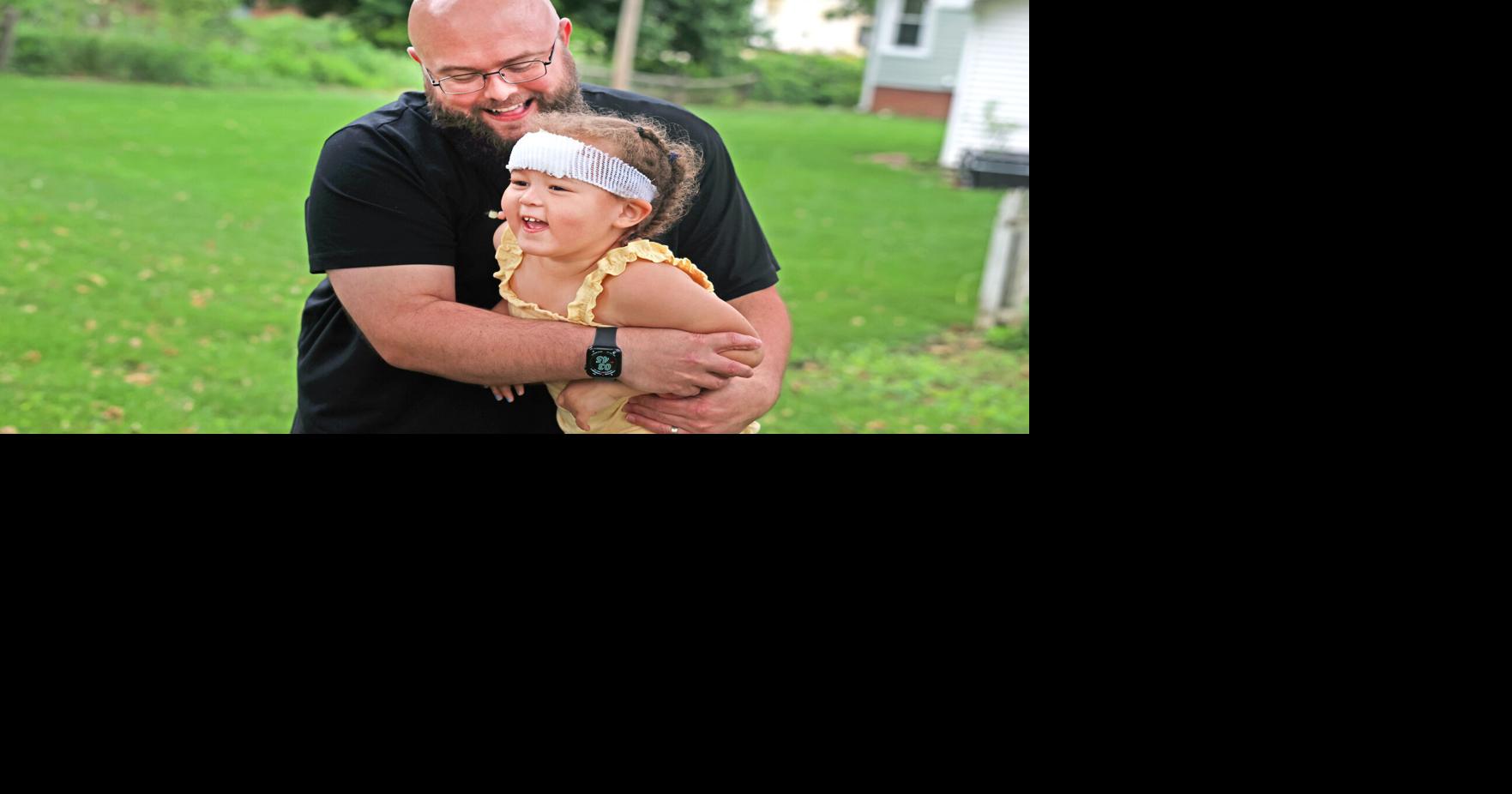 Toddler in dog attack fights back through pain to recover