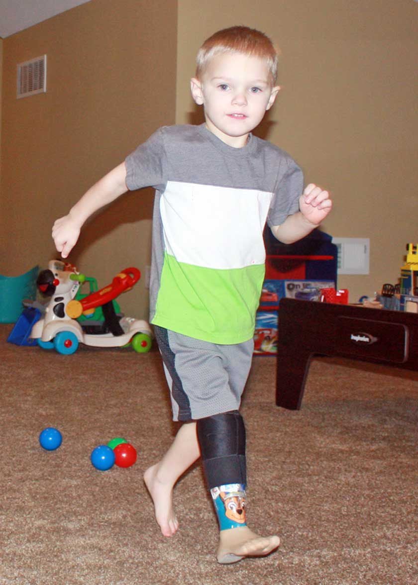 Bright Future For LF Boy Who Lost His Leg In Lawn Mower Accident ...