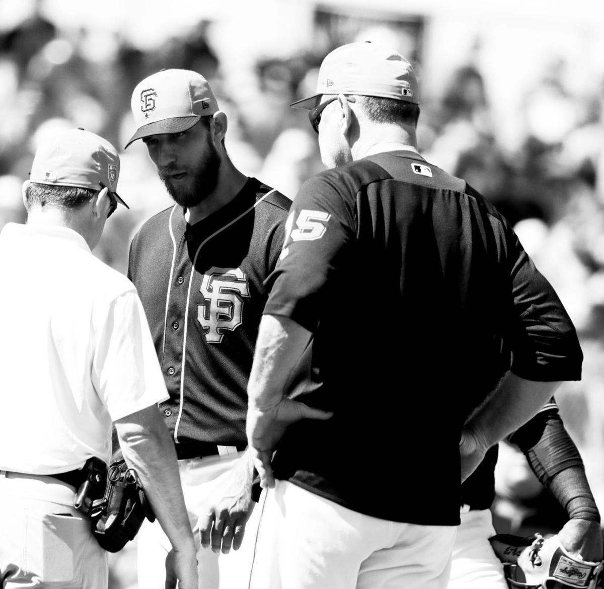 Giants' Madison Bumgarner injured in dirt bike accident