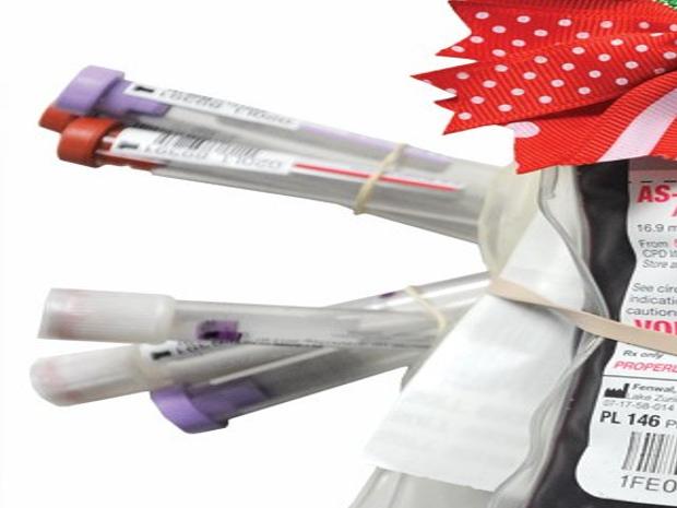 The Gift Of Life Rotarians Organize Holiday Blood Drive To Honor One Of Their Own Members Idahopress Com I decided to check it out when i heard watanuki from xxxholic makes an appearances (more or less). rotarians organize holiday blood drive
