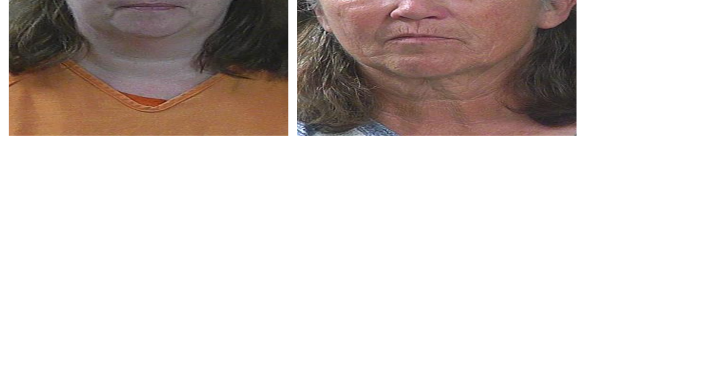 Two women arrested, face first-degree murder charges in connection to ...