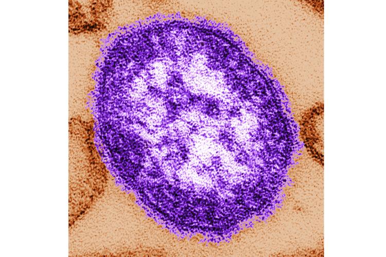Measles Deaths
