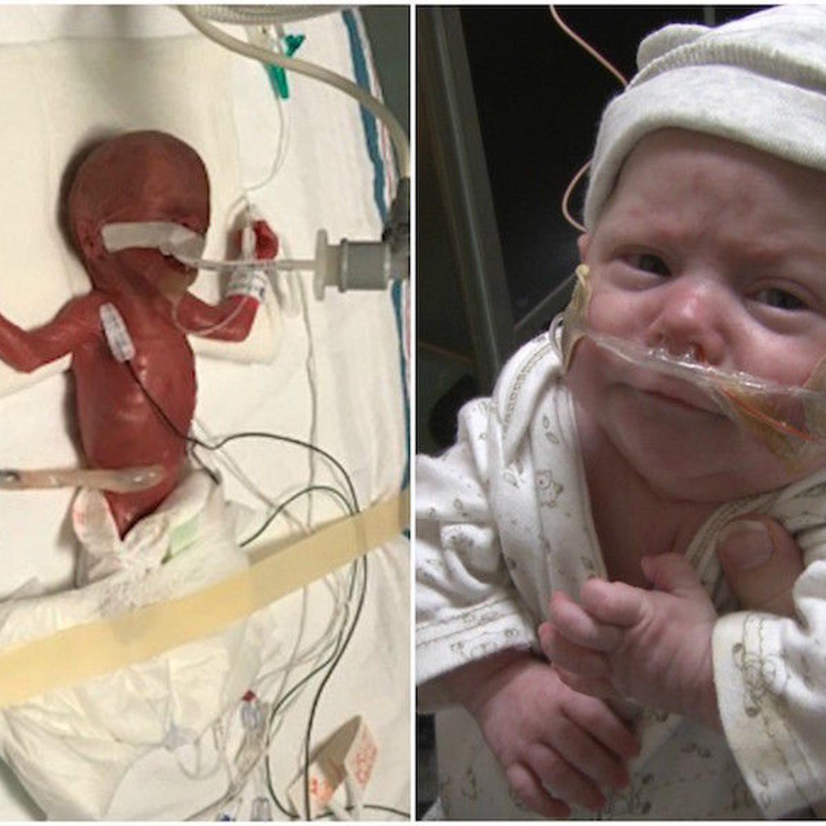 Miracle Baby Infant Born At 24 Weeks Finally Gets To Go Home From Hospital Local Idahostatejournal Com Miracle Baby Infant Born At 24 Weeks Finally Gets To Go Home From Hospital Local Idahostatejournal Com