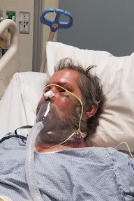 Ray Hanson in ICU