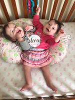 FIRST BIRTHDAY: Conjoined twins in Blackfoot continue to beat odds