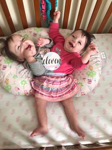 FIRST BIRTHDAY: Conjoined twins in Blackfoot continue to beat odds
