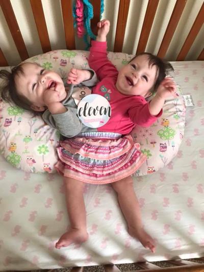 FIRST BIRTHDAY: Conjoined twins in Blackfoot continue to beat odds