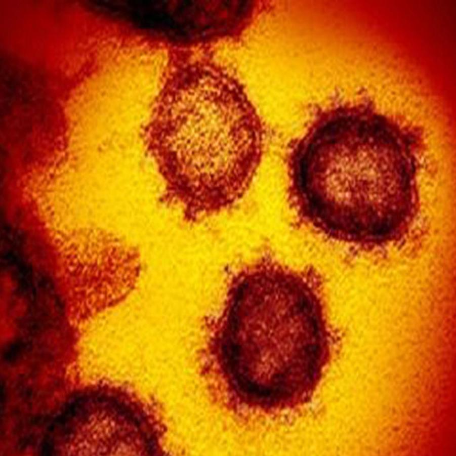 Eastern Idaho Public Health Elevates Lemhi County To Critical Risk Covid 19 Deaths Rapidly Rising In Region Coronavirus Idahostatejournal Com